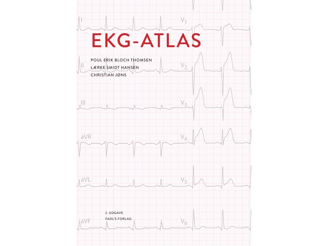 Ekg-Atlas | Poul Erik Bloch Thomsen Christian Jøns, Lærke Smidt Hansen