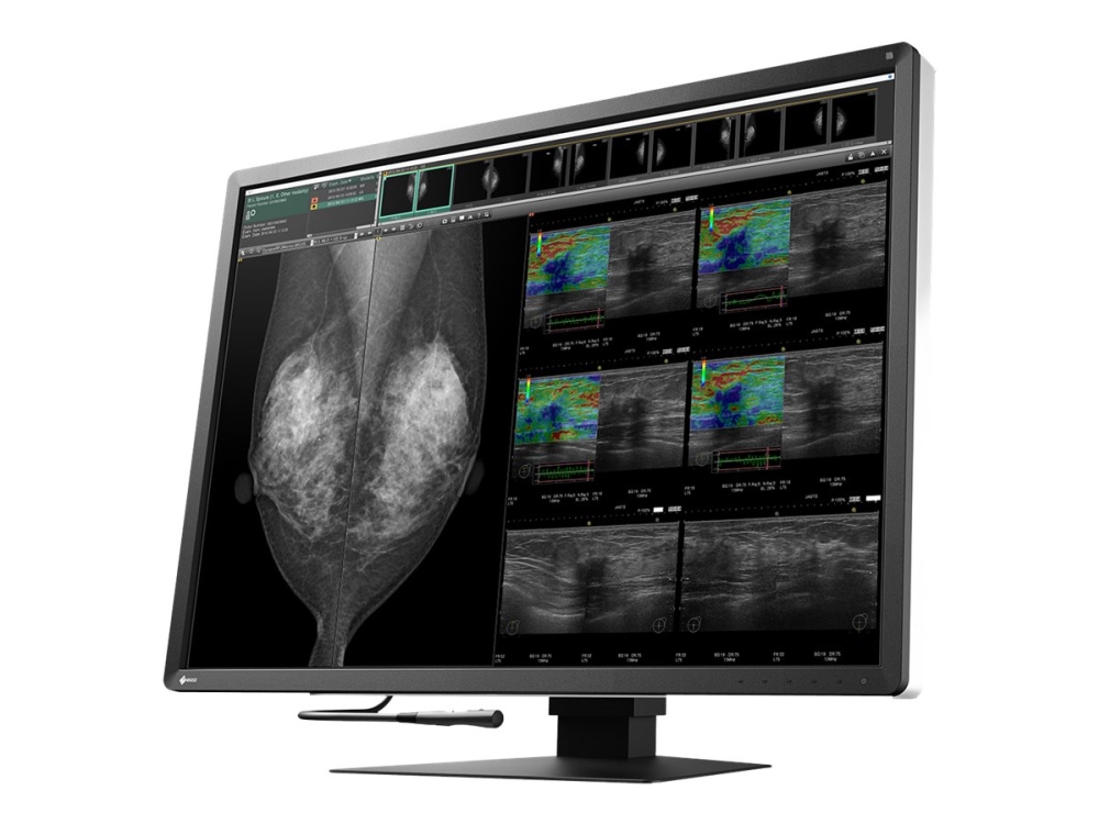 Eizo Radiforce Rx1270, 78,7 Cm (31"), 4200 X 2800 Pixel, Lcd, 12 Ms, Schwarz, Weiß
