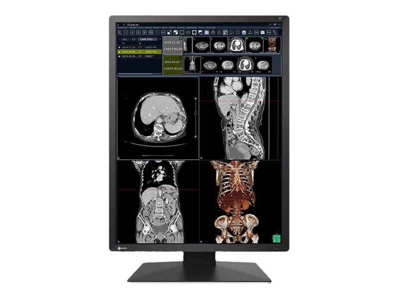 Eizo Radiforce Rx270, 54,1 Cm (21.3"), 1200 X 1600 Pixel, Uxga, Lcd, 20 Ms, Schwarz, Weiß