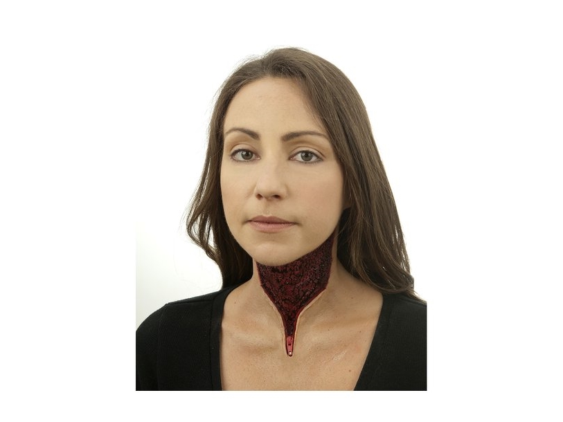 Zip It - Zip-Wunde