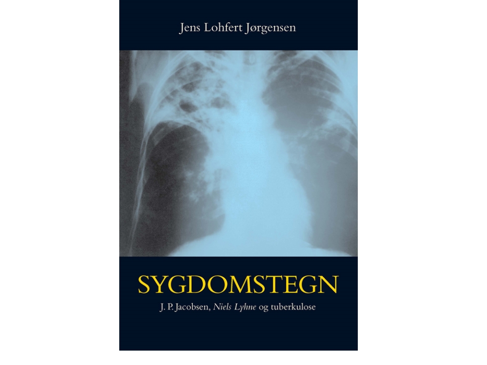 Sygdomstegn | Jens Lohfert Jørgensen